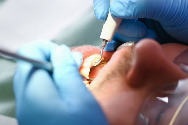 Best Tooth Infection Emergency Dentist  in West Point, VA