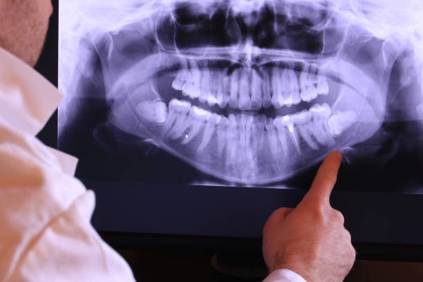 Best Chipped Tooth Repair Near Me  in West Point, VA